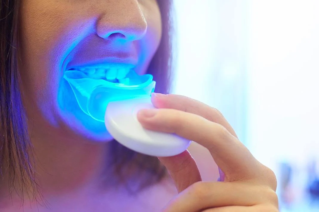 أفضل جهاز ليزر تبييض الأسنان 