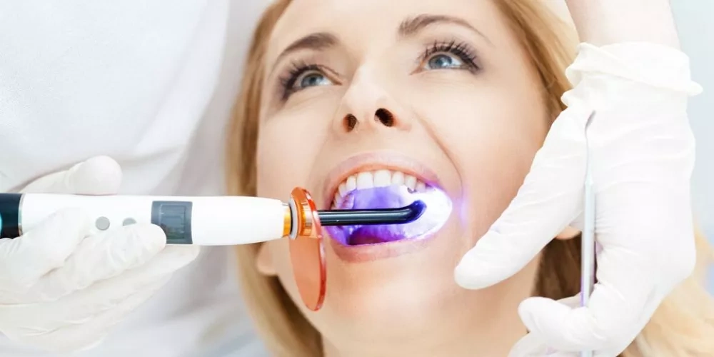 أفضل طريقة لتبييض الاسنان طبياً