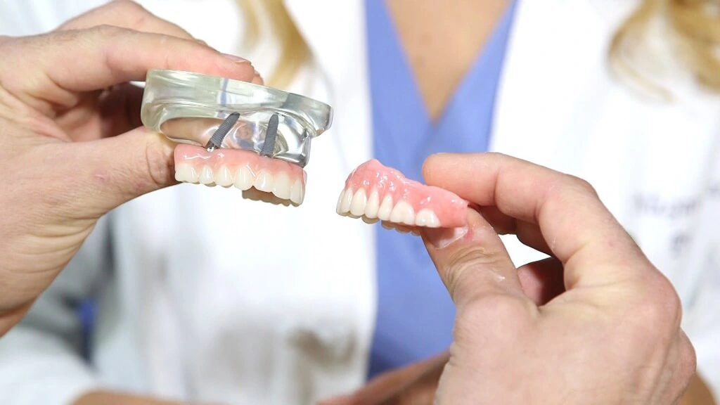 أنواع أطقم الأسنان الكاملة (1)
