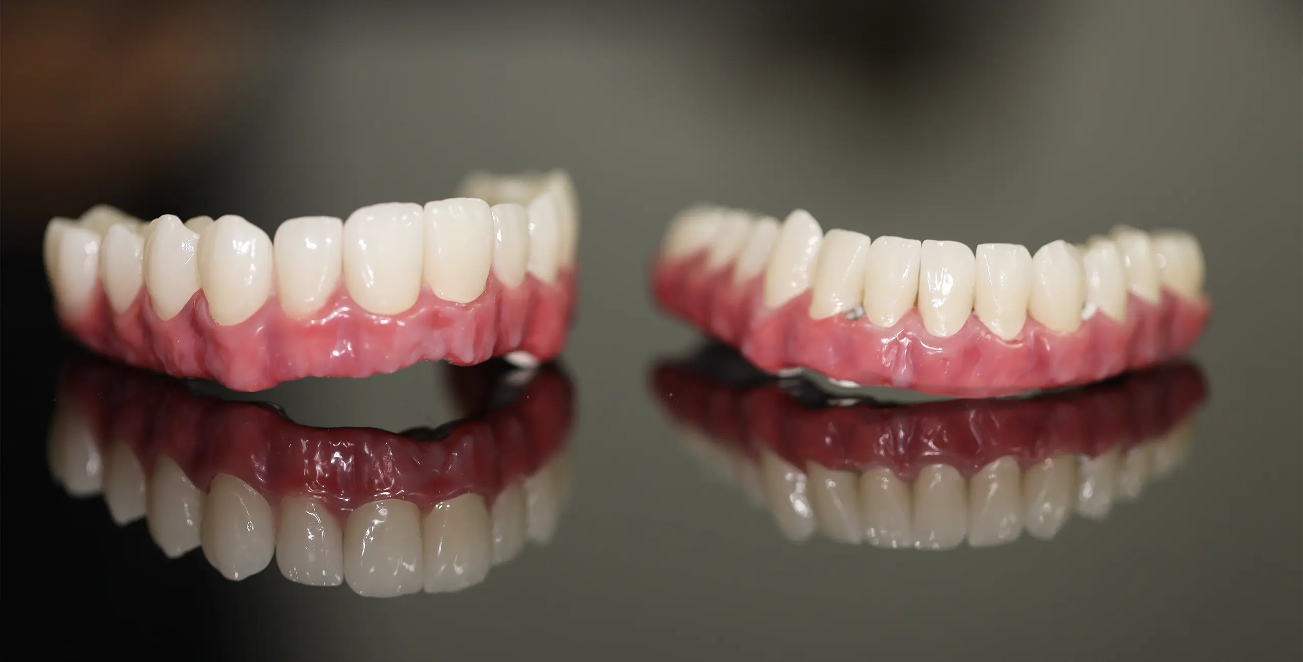 أنواع أطقم الأسنان الكاملة