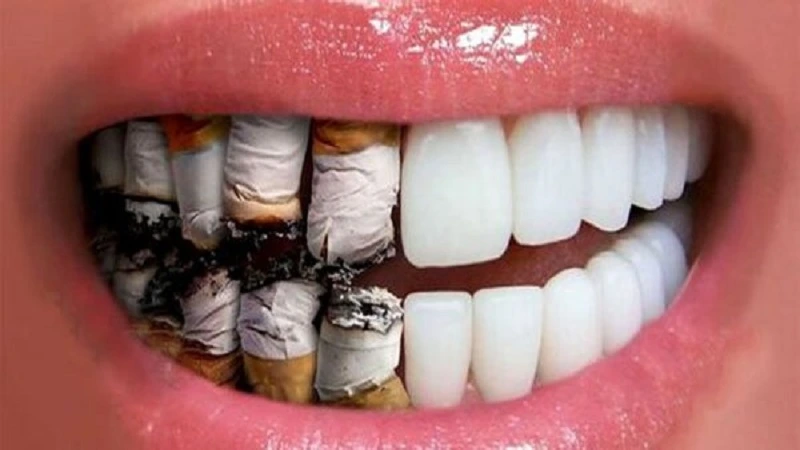 زراعة الأسنان والتدخين
