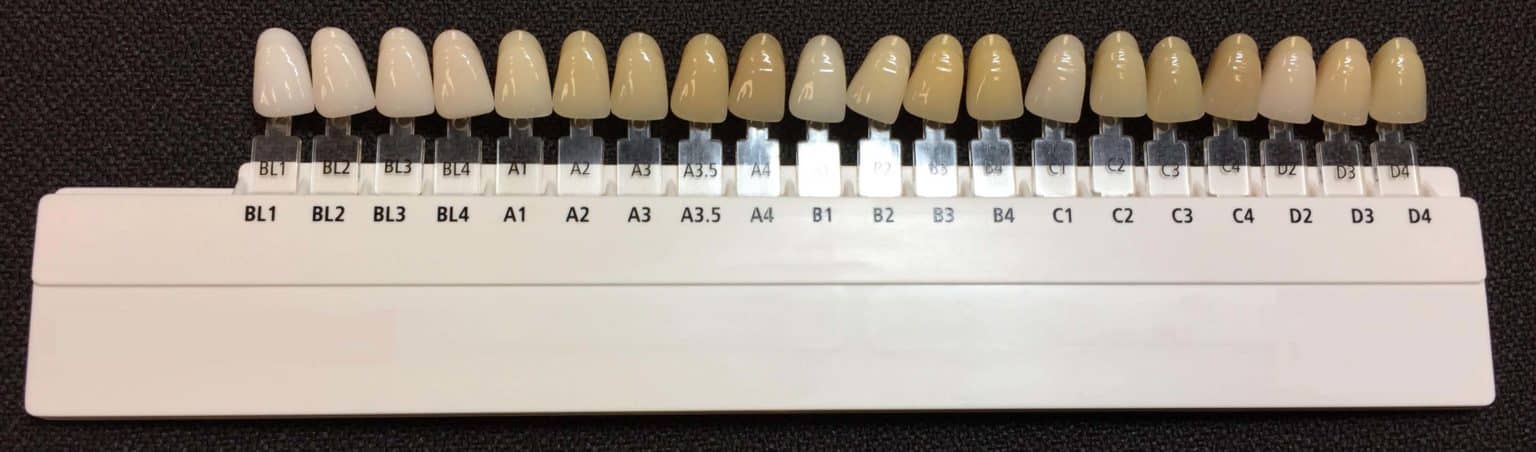 درجات الوان فينير الاسنان