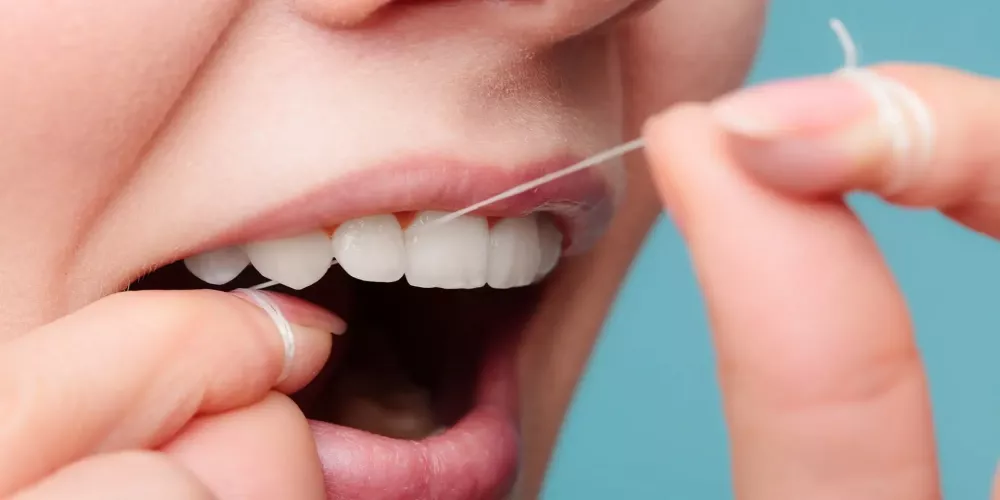 خيط تنظيف جسر الأسنان