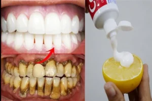طريقة تنظيف صفار الأسنان