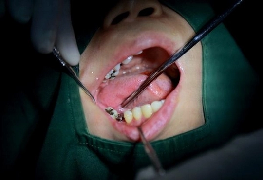 أسعار جراحة الأسنان