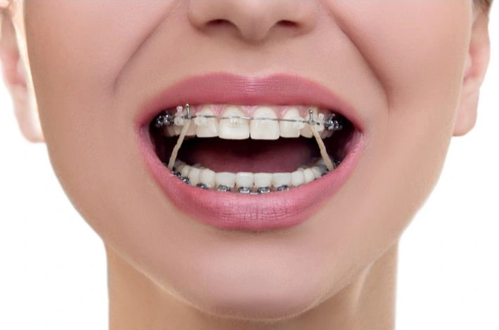 علاج جراحة الأسنان