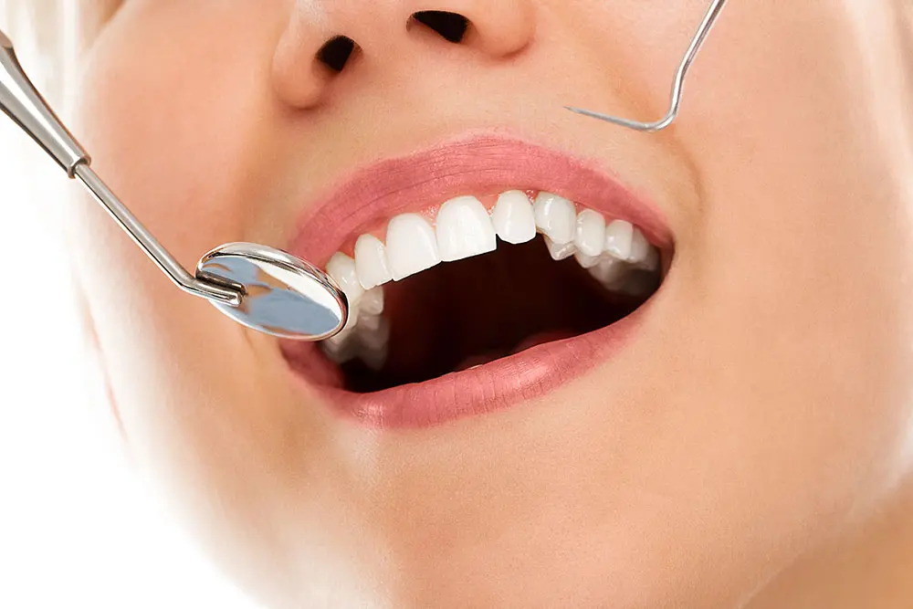 إليك مراحل تركيب ابتسامة هوليود في 7 أيام فقط