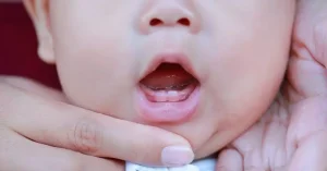 أعراض التسنين عند الأطفال