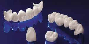 تعرف على طريقة تركيب أسنان الزيركون بالخطوات والصور