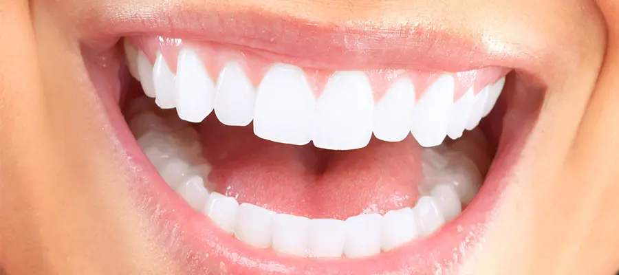 ابتسامة هوليود | 7 ايام تفصلك عن ابتسامة أحلامك