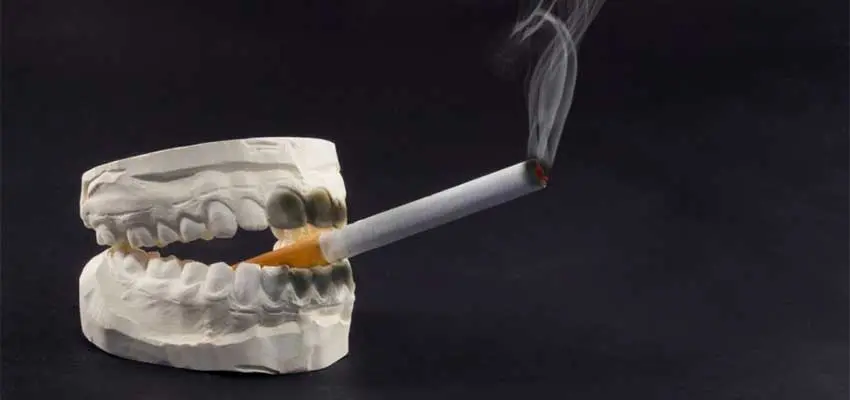 العلاقة بين زراعة الأسنان والتدخين وأضراره بعد عملية الزراعة