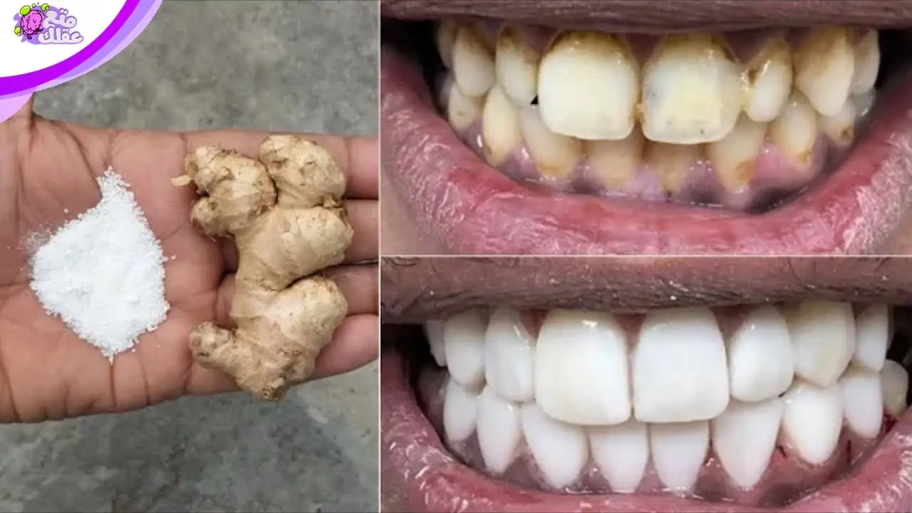 8 طرق تساعد على تبييض الأسنان بالمنزل