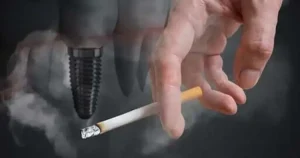 العلاقة بين زراعة الأسنان والتدخين وأضراره بعد عملية الزراعة