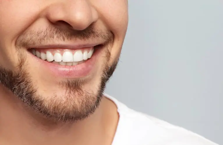 إيجابيات وسلبيات ابتسامة هوليود