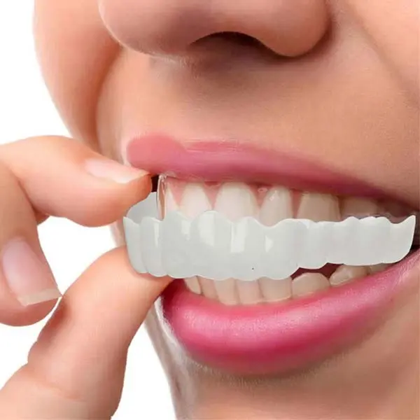 عيوب-ابتسامة-هوليود-المتحركة