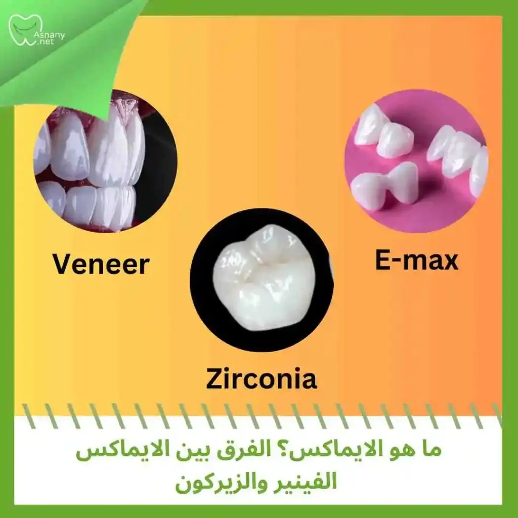 ما-هو-الايماكس؟-الفرق-بين-الايماكس-الفينير-و-الزيركون