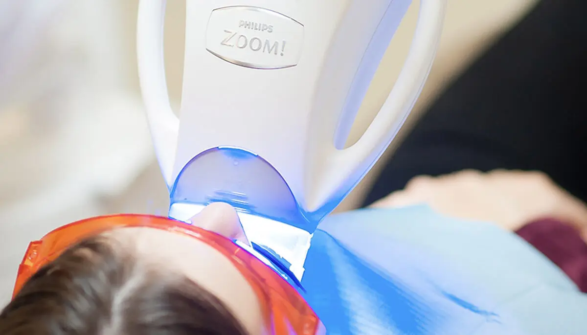 Zoom teeth whitening device: 8 shades in 45 minutes