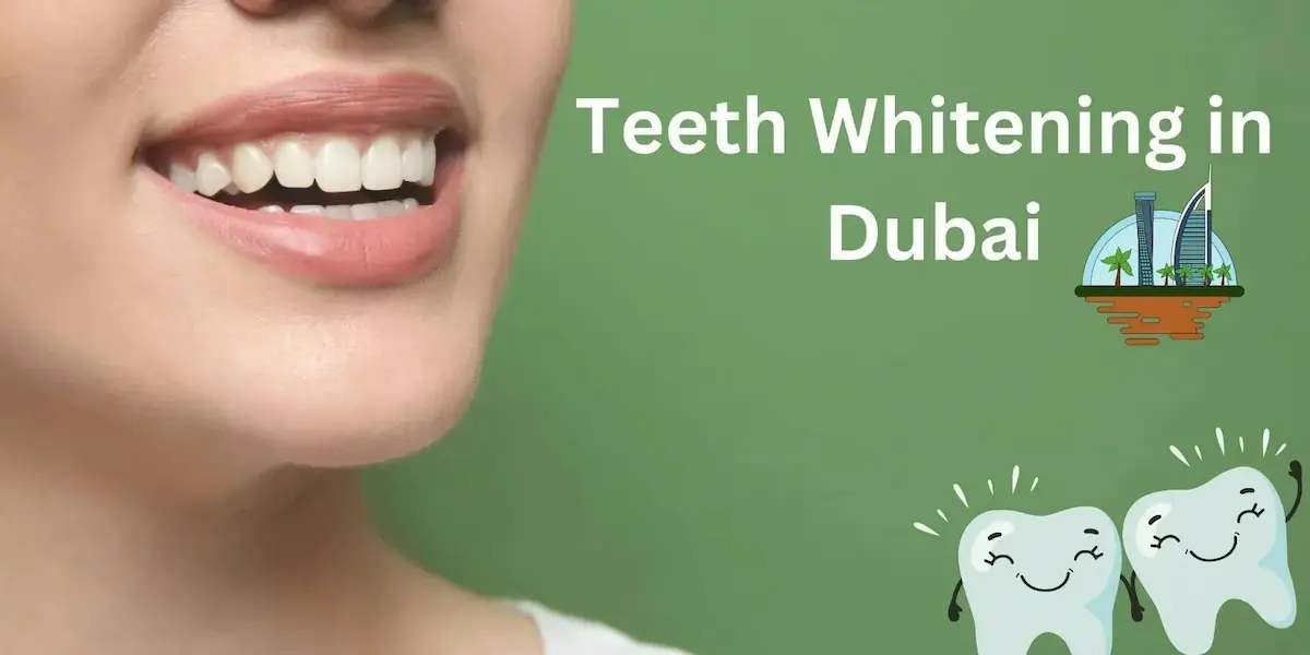 Teeth Whitening in UAE: Complete Guide to Methods, Costs, Benefits & Safety